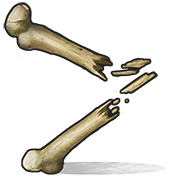 Bones